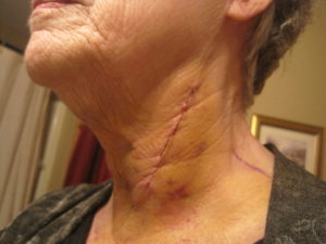 This is definitely the neck of an old woman, but my heart and mind are stil young.